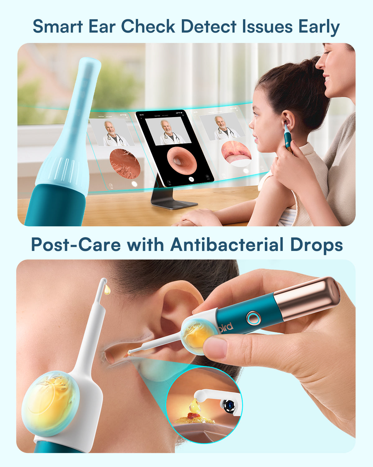 Bebird Ultra Kit: Ultimate&Affordable Ear-Clean Solution