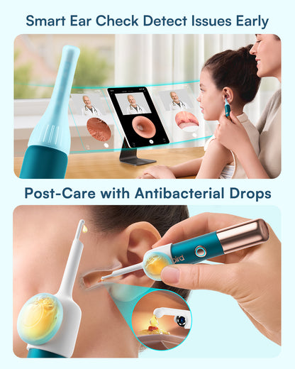 Bebird Ultra Kit: Ultimate&Affordable Ear-Clean Solution