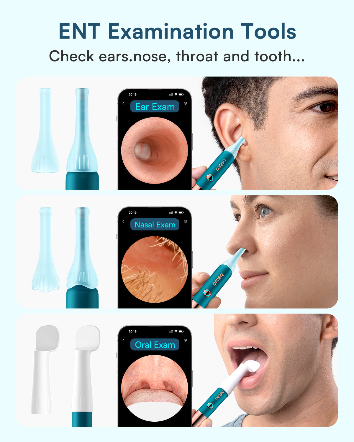 Bebird Ultra Kit: Ultimate&Affordable Ear-Clean Solution