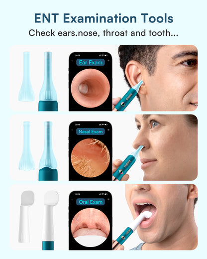 Bebird Ultra Kit: Ultimate&Affordable Ear-Clean Solution