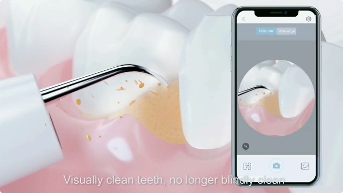 World’s First Ultrasonic Teeth Cleaner with Camera